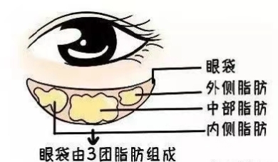 商丘缔莱美周义龙长科普：怎么区分卧蚕、眼袋和泪沟？